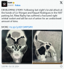 Screenshot 2024-10-30 at 23-38-01 WWE Announces Rhea Ripley Is Injured Won't Provide Timeline ...png